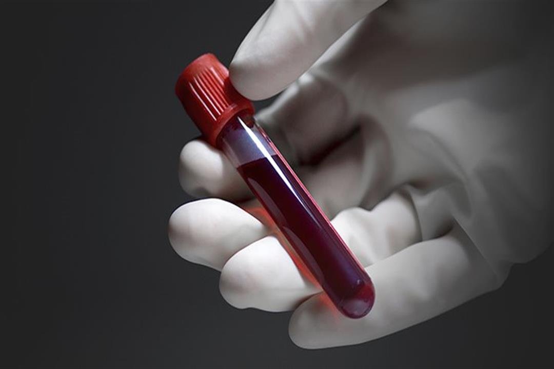 1. Blood Biomarkers